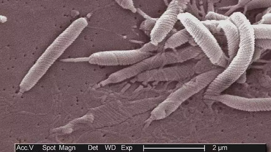 Helicobacter pylori: jedná se o příznaky infekce, která postihuje polovinu populace.